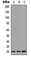TNFRSF17 / BCMA Antibody (Internal)