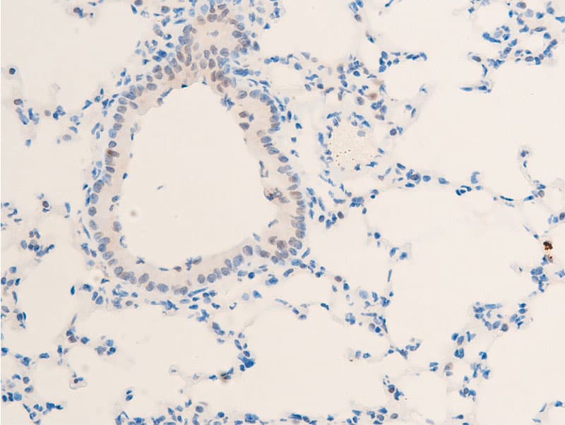 MYC / c-Myc Antibody (phospho-Thr58)