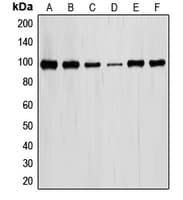Polyclonal Rabbit anti-Human STAT6 Antibody (Internal, IHC, WB)
