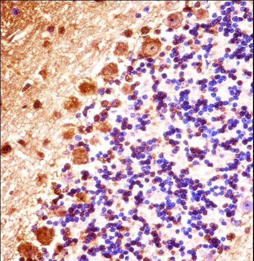 Polyclonal Rabbit anti-Mouse STK32B Antibody (aa315-343, IHC, WB)