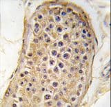 RICTOR Antibody (aa236-267)