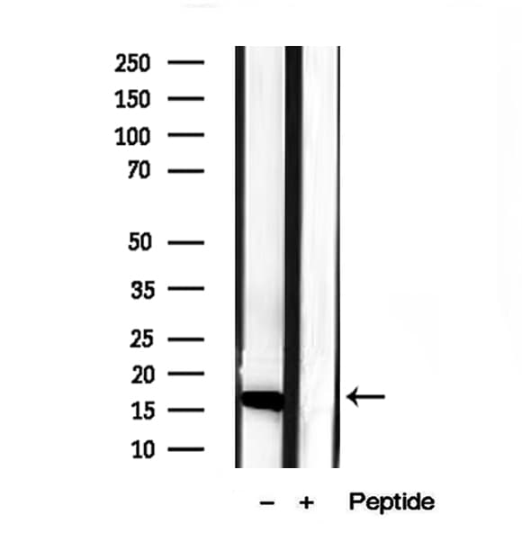 CHCHD2 Antibody