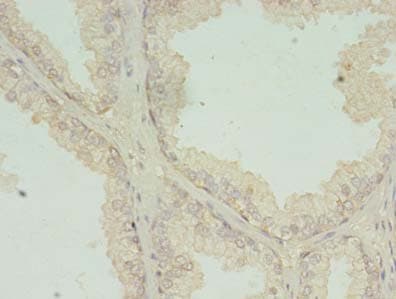 IHC-plus™ RCD1 / RQCD1 Antibody