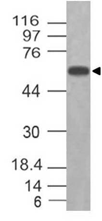 RORA / ROR Alpha Antibody