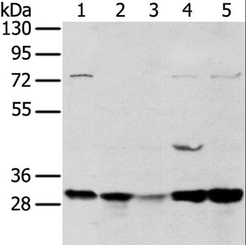TPD52L2 / HD54 Antibody