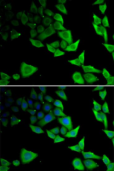 Polyclonal Rabbit anti-Human SNCA / Alpha-Synuclein Antibody (IHC, IF, WB)