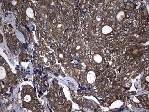 Monoclonal Mouse anti-Human NME1 / NM23 Antibody (clone UMAB92, IHC, IF, WB)