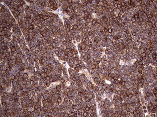 LRRTM1 Antibody (aa182-422, clone OTI5H9)