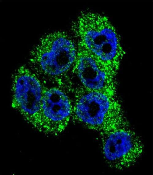 TRPM8 Antibody (aa263-292)