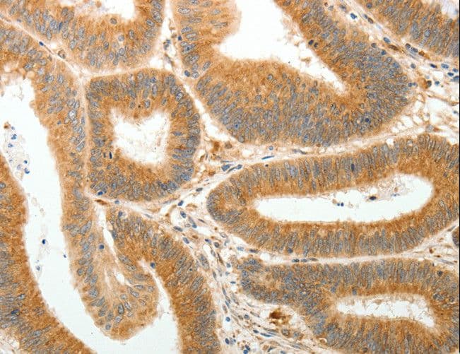 AKR1B1 / Aldose Reductase Antibody