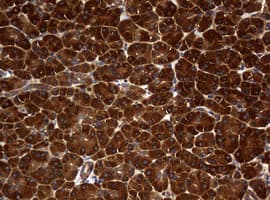 NME1 / NM23 Antibody (clone OTI7D6)