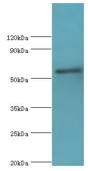 IKZF3 / AIOLOS Antibody (aa280-450)