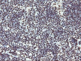 Monoclonal Mouse anti-Human NONO / P54NRB Antibody (clone OTI2E7, IHC, WB)