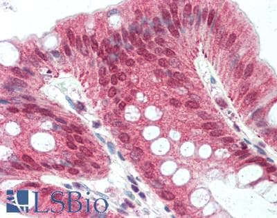 IHC-plus™ RAB2A / RAB2 Antibody