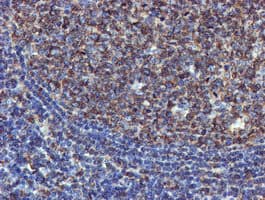 TUBAL3 Antibody (clone OTI5E4)