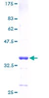 Human HMGN3 Protein (Recombinant GST)