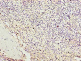 Polyclonal Rabbit anti-Human C4orf37 Antibody (IHC, WB)