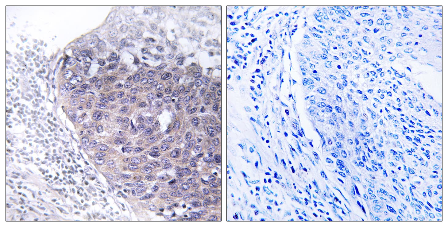 MTG2 / GTPBP5 Antibody (aa71-120)