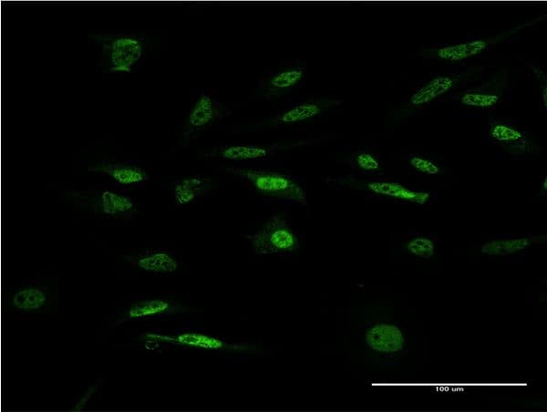 IHC-plus™ FOXK2 / ILF Antibody (clone 4A11)