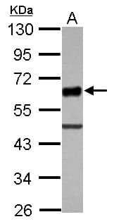 UBASH3A / CLIP4 Antibody