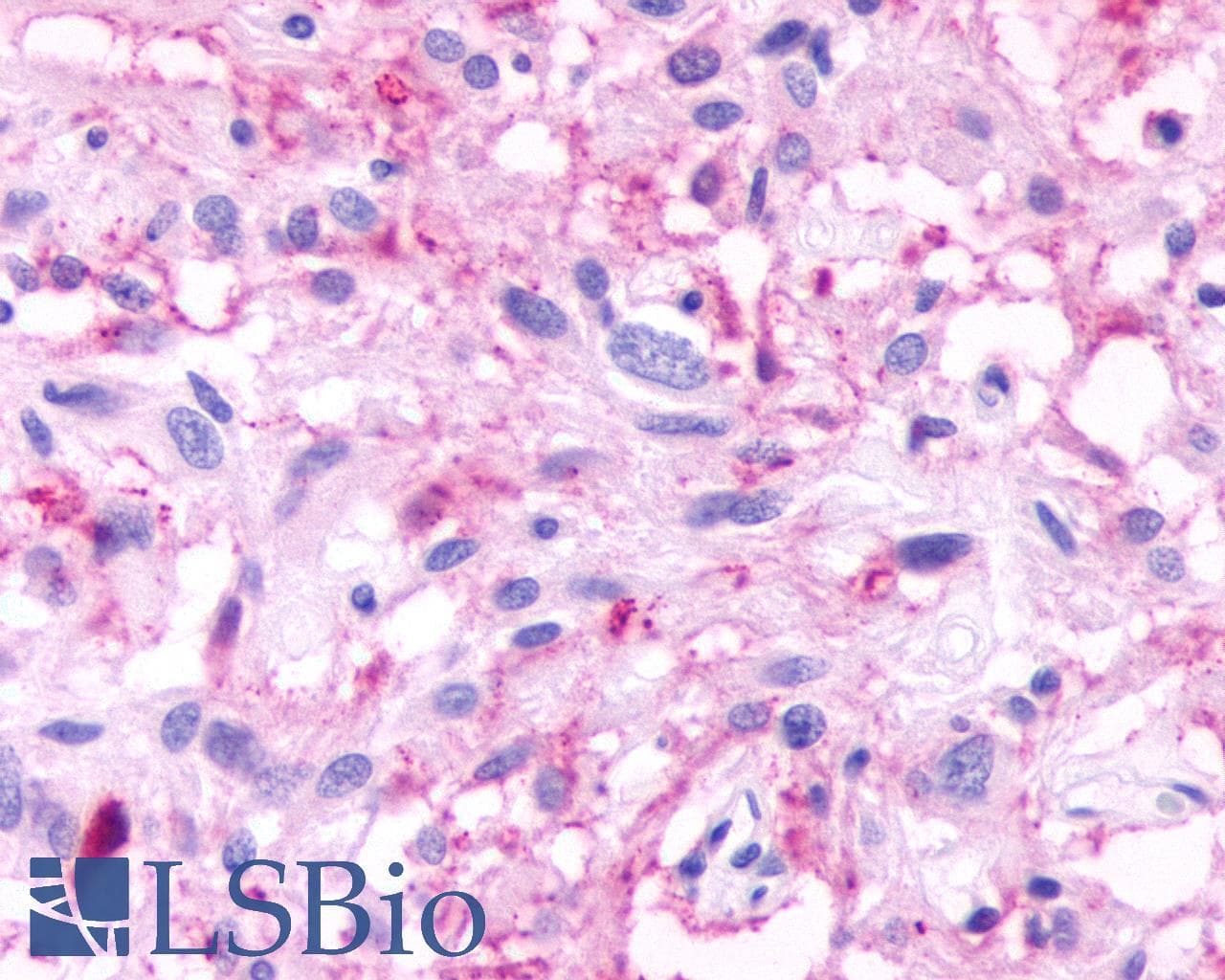 PathPlus™ Polyclonal Rabbit anti-Human GPR61 Antibody (C-Terminus, IHC)
