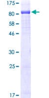 Human SRC Protein (Recombinant GST)