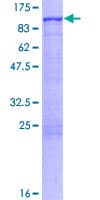 Human ADRBK1 / GRK2 Protein (Recombinant GST)