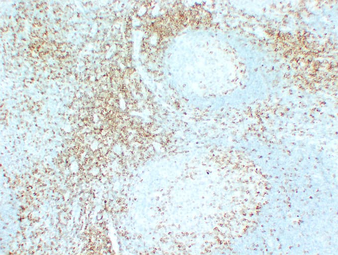 CD5 Antibody (clone ABT-CD5)