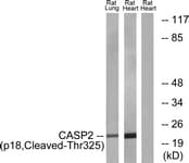 Polyclonal Rabbit anti-Human CASP2 / Caspase 2 Antibody (aa276-325, WB)