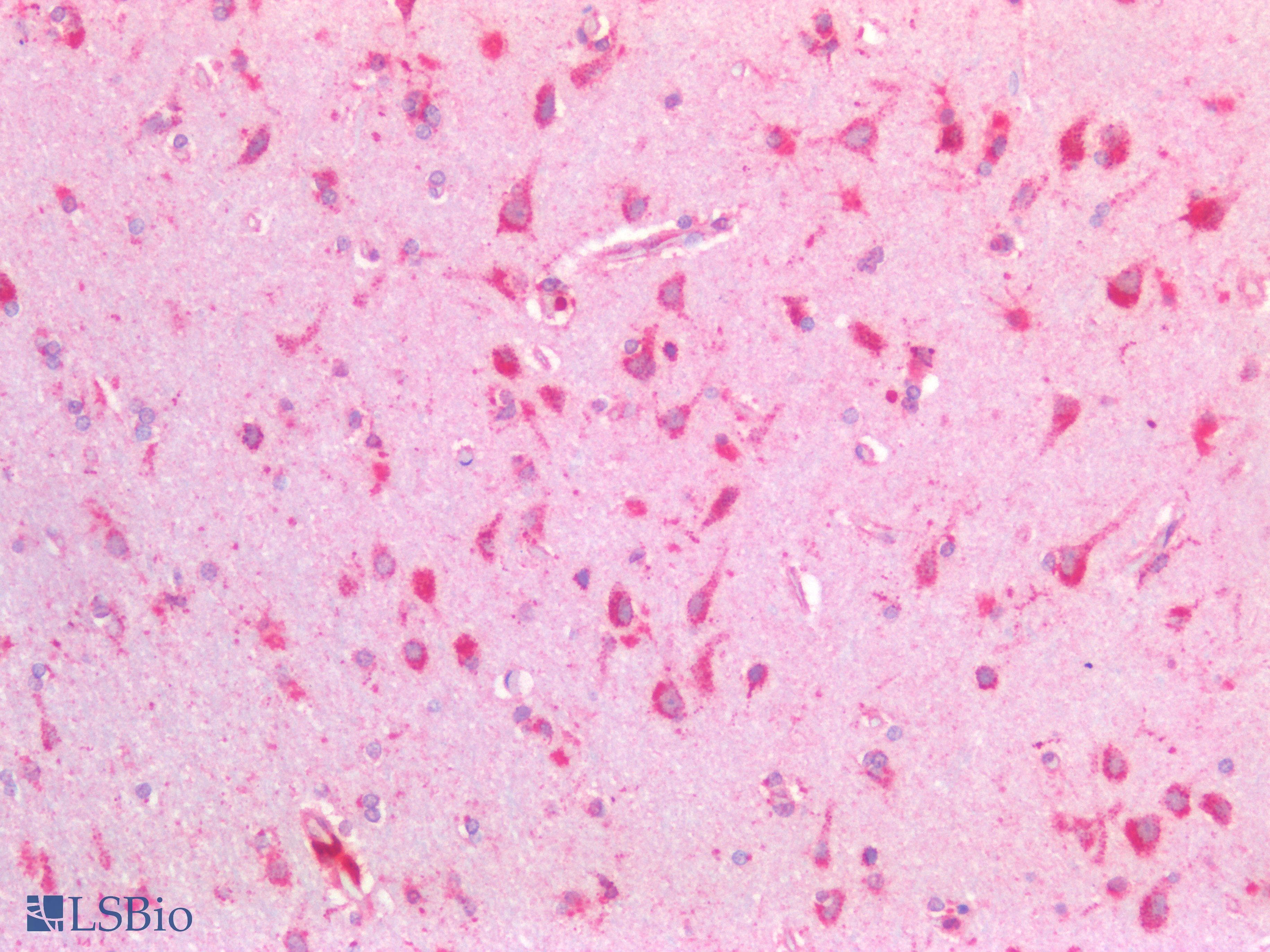 PathPlus™ Polyclonal Rabbit anti-Human HEXB Antibody (IHC)