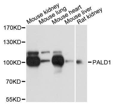 Polyclonal Rabbit anti-Human PALD1 / Paladin 1 Antibody (WB)