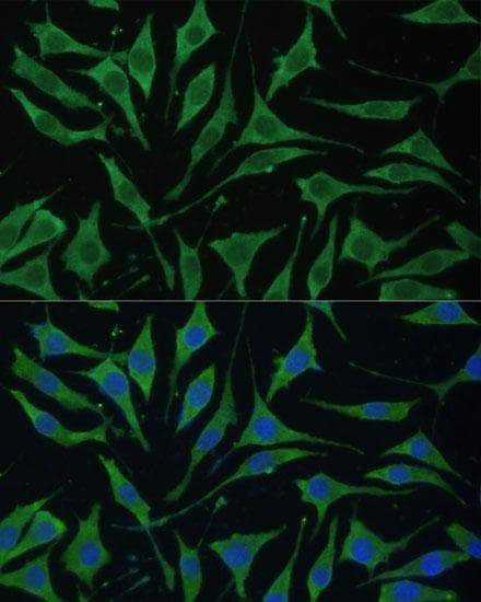 Polyclonal Rabbit anti-Human TIMM8B Antibody (IHC, IF)