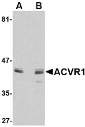 ALK2 / ACVR1 Antibody