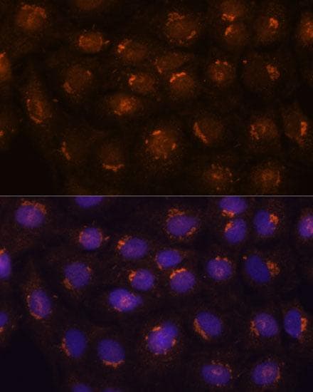 B3GNT4 Antibody