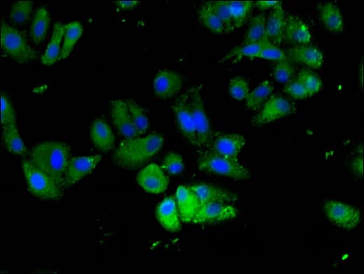Polyclonal Rabbit anti-Human FAM111A Antibody (IHC, IF)