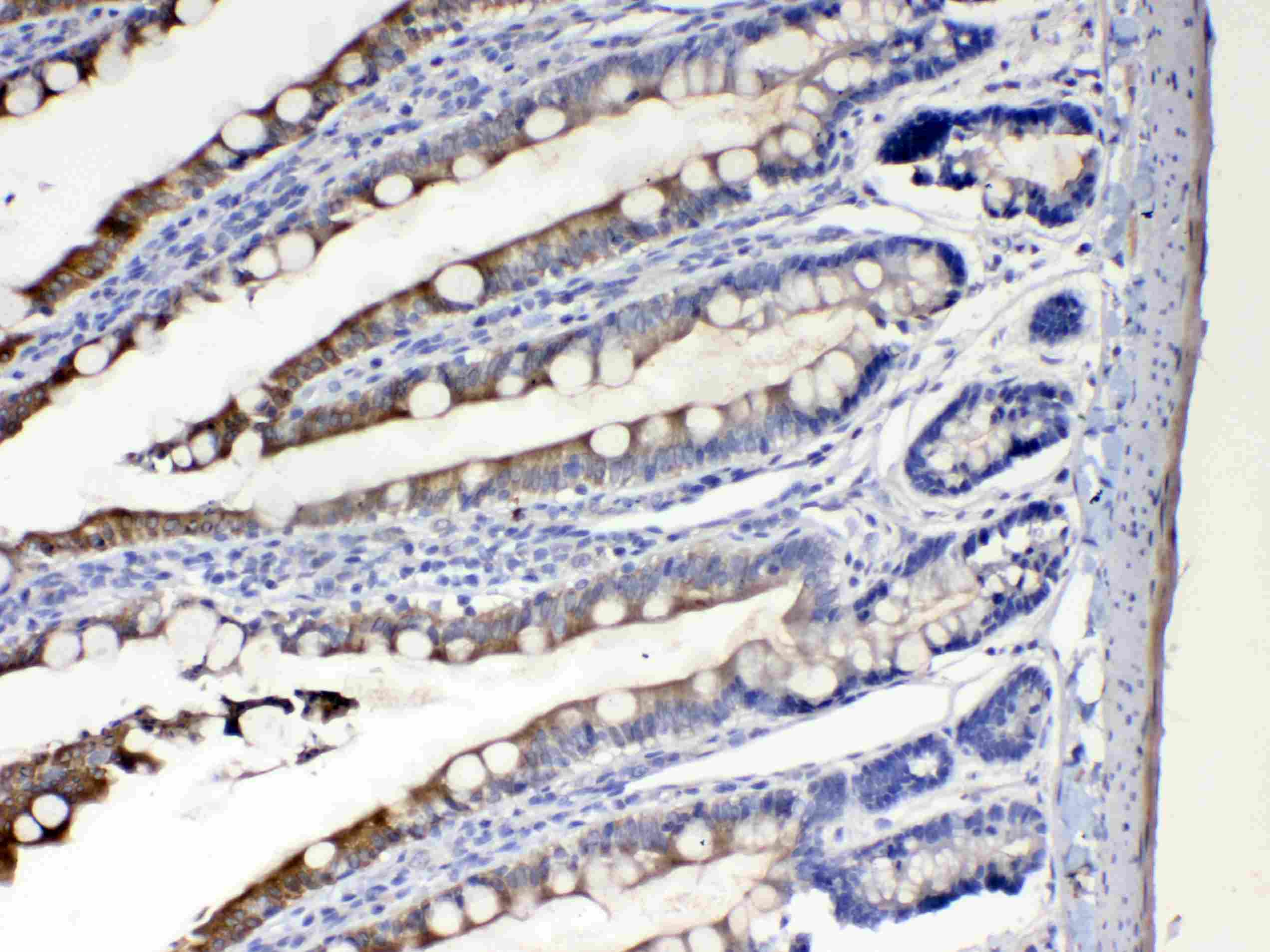 Polyclonal Rabbit anti-Human CYP2D6 Antibody (IHC, WB)
