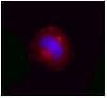 IHC-plus™ Monoclonal Mouse anti-Human VCP Antibody (clone 4G9, IHC, IF, WB)