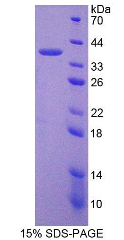 Human PADI6 Protein (Recombinant His-T7)