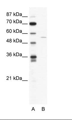 ARFGAP2 / ZNF289 Antibody (aa114-163)