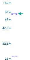 Human RNF38 Protein (Recombinant GST)
