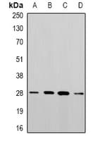 Polyclonal Rabbit anti-Human PGAM2 Antibody (WB)
