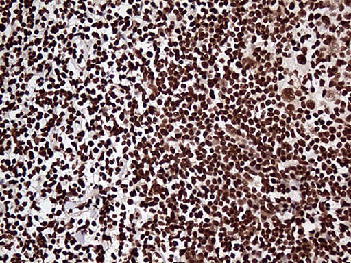 Monoclonal Mouse anti-Human ZRANB2 / ZNF265 Antibody (clone OTI2E3, aa95-320, IHC, WB)