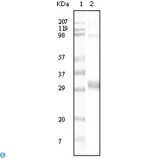 SLC17A1 / VGLUT1 Antibody