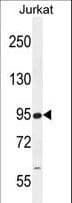 Polyclonal Rabbit anti-Human RSBN1 Antibody (aa51-78, IHC, WB)