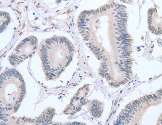Polyclonal Rabbit anti-Human APEX1 / APE1 Antibody (IHC, WB)