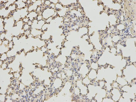 IHC-plus™ ABAT Antibody