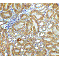Polyclonal Rabbit anti-Mouse DFFB Antibody (IHC, IF, WB)