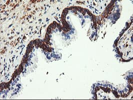 PFKP Antibody (clone OTI1F2)