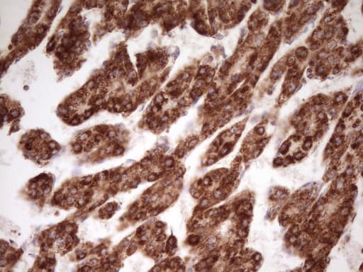 LRRC6 Antibody (clone OTI7E9, Carrier-free)