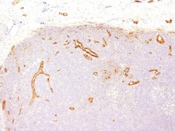 VWF / Von Willebrand Factor Antibody (aa845-949, clone IIIE2.34, Azide-free, BSA-free)